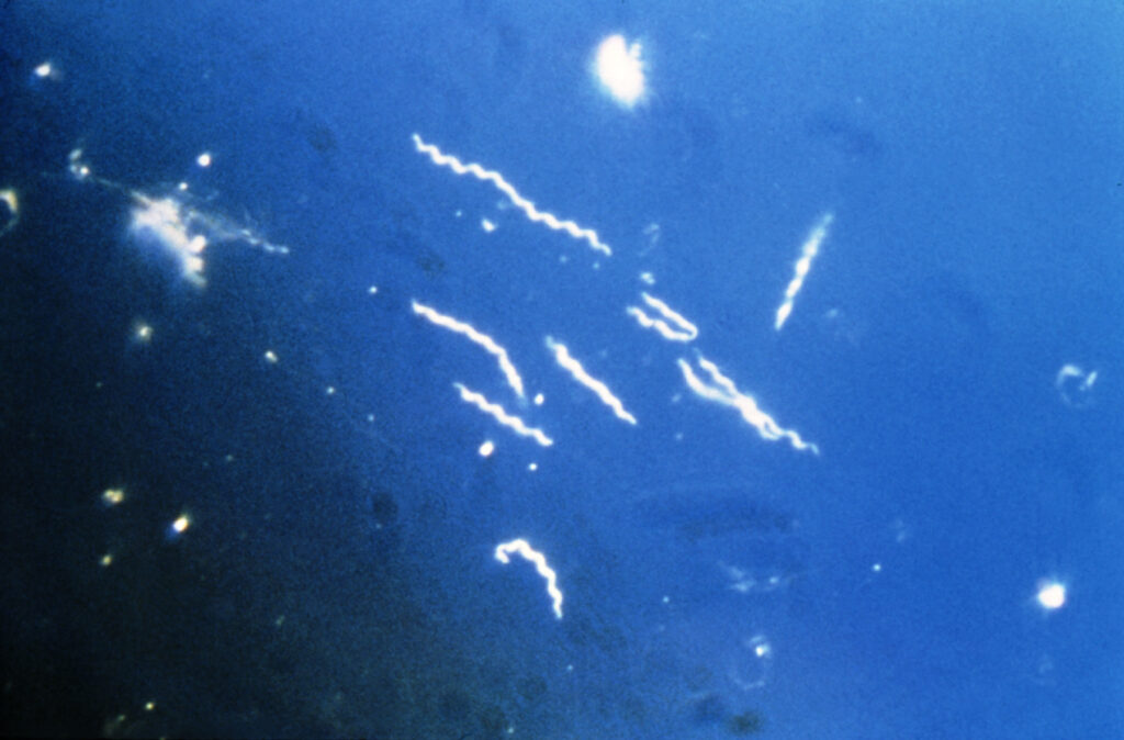Lyme Disease is thought to be caused by the spirochete (a spiral shaped bacteria), Borrelia burgdorferi, which is similar to the syphilis organism. Lyme Disease does not discriminate by income, gender, age, or culture. Current climate changes are creating a higher risk for infection due to an increased tick population. Lyme Disease is thought to be caused by the spirochete (a spiral shaped bacteria), Borrelia burgdorferi, which is similar to the syphilis organism. Lyme Disease does not discriminate by income, gender, age, or culture. Current climate changes are creating a higher risk for infection due to an increased tick population.